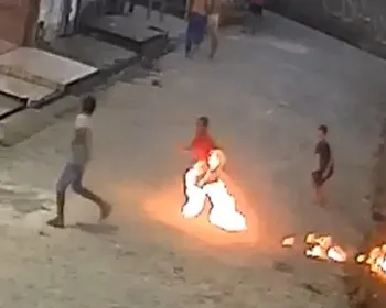 Mãe de menino ferido por fogos de artifício em Rio Largo relata desespero