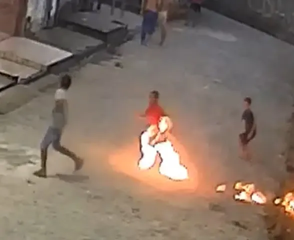 Mãe de menino ferido por fogos de artifício em Rio Largo relata desespero