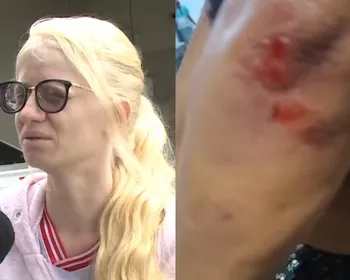 'Tentou arrancar pedaços do corpo com os dentes': filha relata terror vivido pela mãe