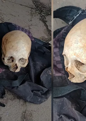 Crânio humano é encontrado em parada de ônibus