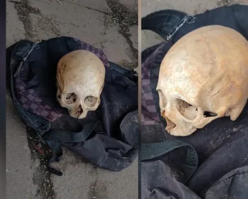 Crânio humano é encontrado em parada de ônibus