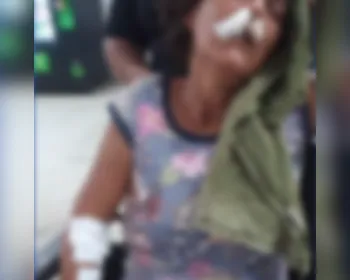 Mulher espancada em Porto Real do Colégio já teria sido vítima de agressões anteriores, diz família
