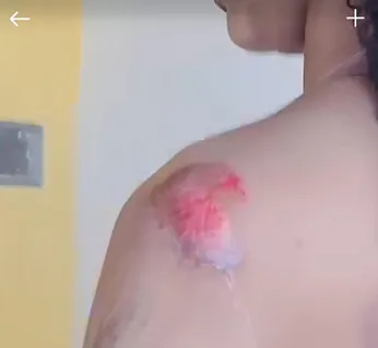 Jovem pula de moto por aplicativo após suspeitar de tentativa de estupro em Rio Largo