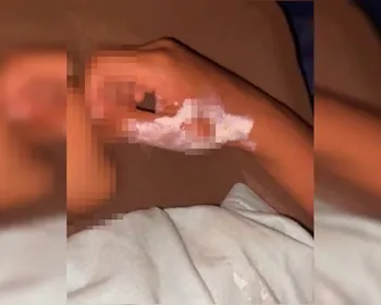 Mãe aquece colher no fogão e queima mãos do filho de propósito