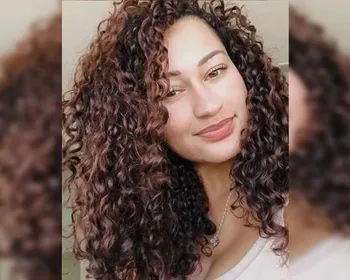 VÍDEO: Mulher que foi acorrentada diz que ex jogou ácido na boca dela