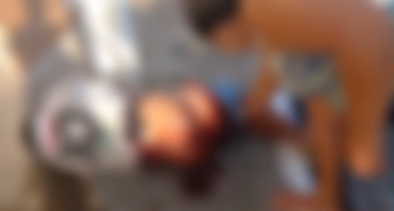 Homem morre em Igaci após ter pedaço de madeira introduzido no ânus e o intestino perfurado