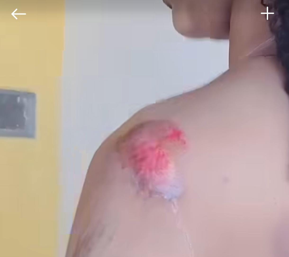 Jovem pula de moto por aplicativo após suspeitar de tentativa de estupro em Rio Largo