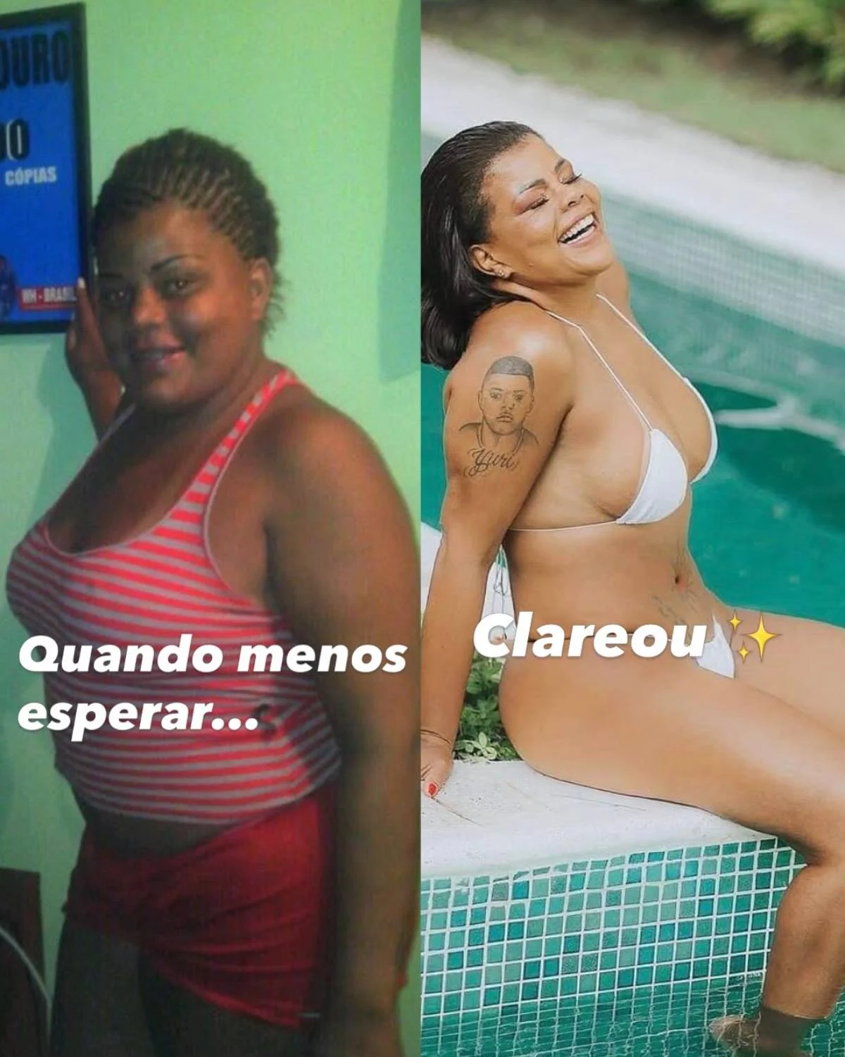 Tati Quebra Barraco mostra antes e depois após 26 cirurgias; fotos