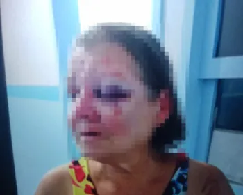 Polícia indicia filho que espancou mãe de 63 anos em Campo Alegre