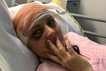 
			
				Mulher é diagnosticada com câncer no cérebro ao ouvir barulho estranho
			
			