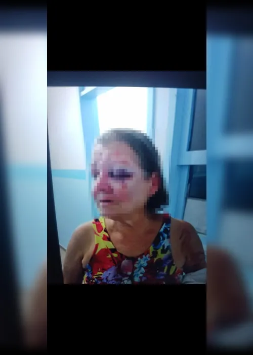 
				Polícia indicia filho que espancou a mãe em Campo Alegre
			
			