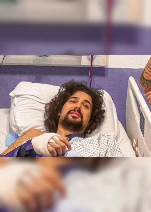 
				Vitor diCastro, do MesaCast BBB, sofre acidente e passa por cirurgia
			
			