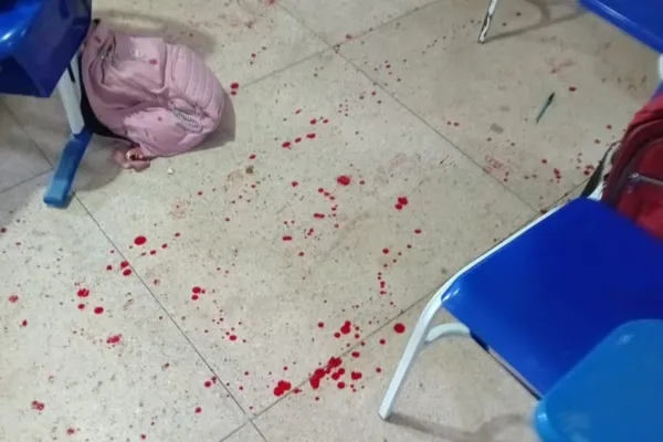 
				
					Estudante atira em colega dentro de escola na cidade de Igaci
				
				