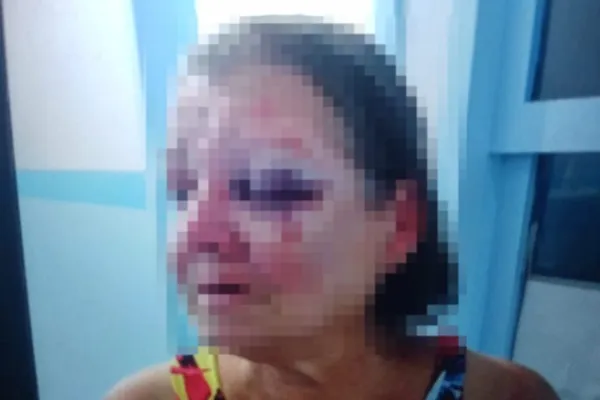 
				
					Polícia indicia filho que espancou a mãe em Campo Alegre
				
				