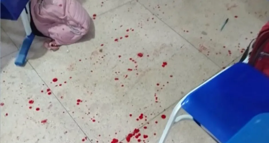 A vítima foi atingida com disparos na região da cervical, do tórax, do abdômen e nos braços e sobreviveu.