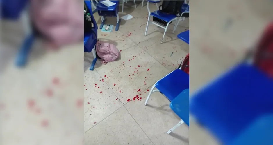 A vítima foi atingida com disparos na região da cervical, do tórax, do abdômen e nos braços e sobreviveu.
