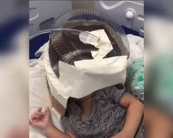 Bebê que usou capacete de oxigênio feito de tampa de bolo deixa UTI