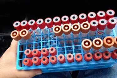 
			
				Adeal inicia coleta de amostras para investigar influenza aviária e doença de Newcastle
			
			