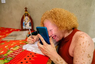 
			
				Alagoana transforma experiências em conhecimento para ajudar albinos
			
			
