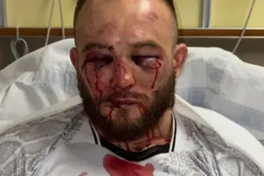 
			
				Lutador compartilha estrago feito por brasileiro no UFC
			
			