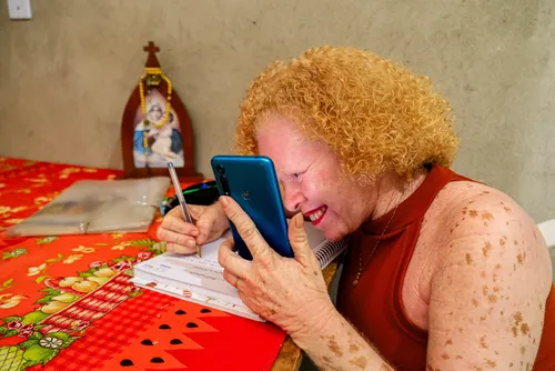
				Alagoana transforma experiências em conhecimento para ajudar albinos
			
			