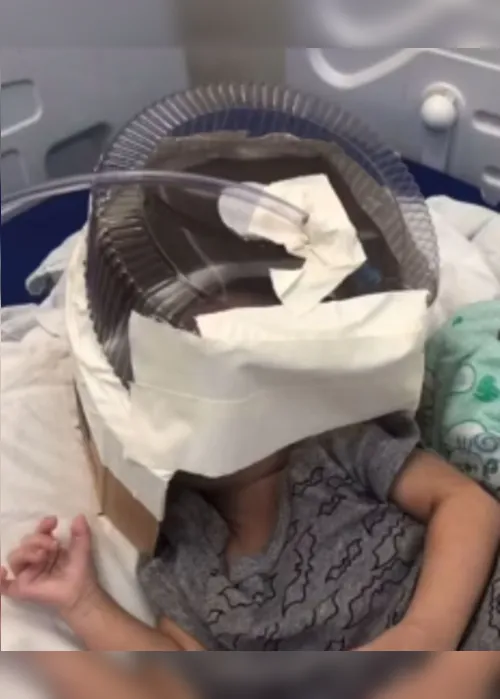 
			
				Bebê que usou capacete de oxigênio feito de tampa de bolo deixa UTI
			
			
