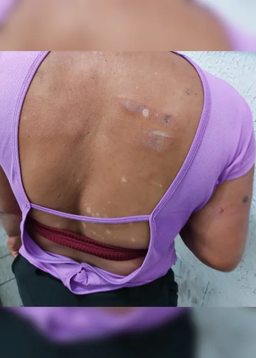 
				Jovem é preso por agredir companheira com ripa de madeira
			
			