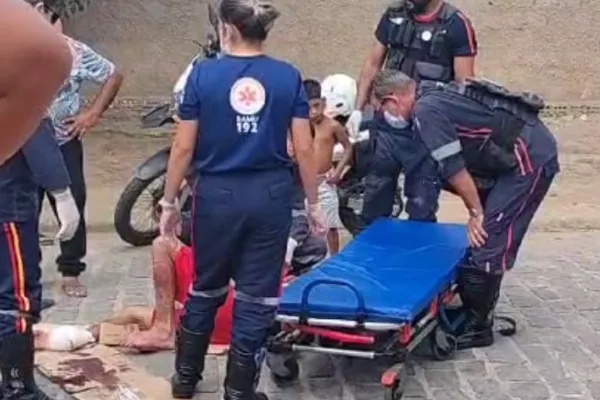 
				
					Homem fica ferido após colisão entre motocicleta e carro em Arapiraca
				
				
