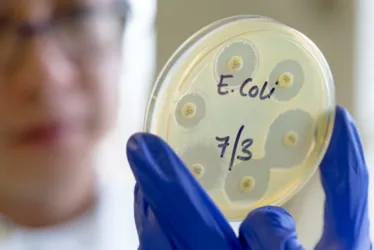 
			
				E.coli: entenda bactéria que infectou triatleta ao nadar no rio Sena
			
			