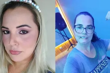 
			
				Influencer de SC que perdeu lábio após harmonização tenta novo enxerto
			
			