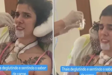 
			
				Jovem que cheirou pimenta tem avanços e sente sabor de carne
			
			