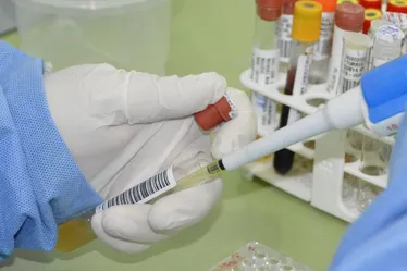 
			
				Alagoas registrou 115 casos de Oropouche em 2024, aponta Sesau
			
			