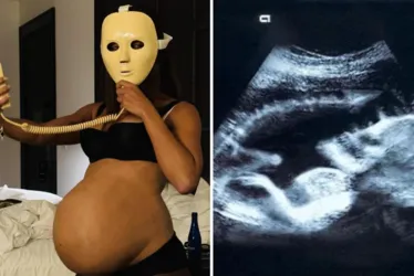 
			
				Após foto “grávida”, Anitta publica registro de ultrassom
			
			