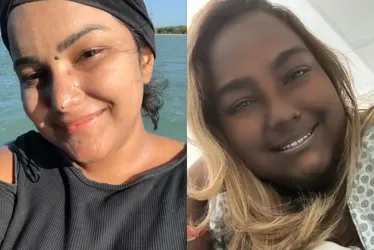 
			
				Jovem com tumor raro começou a perceber mudança na cor da pele cinco anos após o diagnóstico
			
			