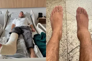 
			
				Lucas Rangel quebra tornozelo e passa por cirurgia a menos de um mês para o casamento
			
			