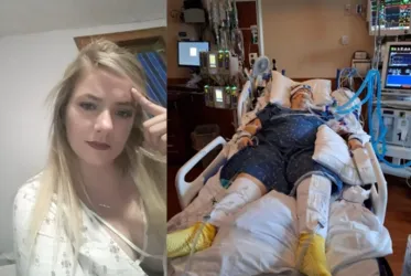 
			
				Mulher fica 11 dias em coma após colapso pulmonar causado por vape
			
			