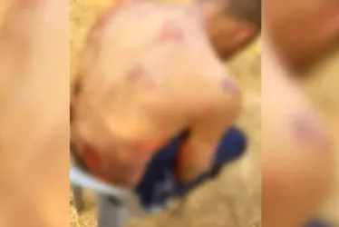 
			
				Suspeito de roubar mercado tem corpo queimado por dono do comércio
			
			