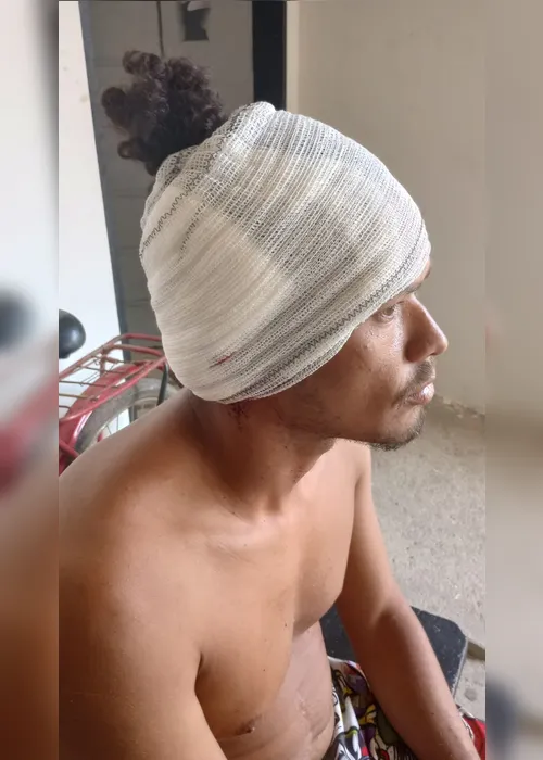 
				Embriagada, mulher tenta matar ex-namorado a facadas em Feira Grande
			
			