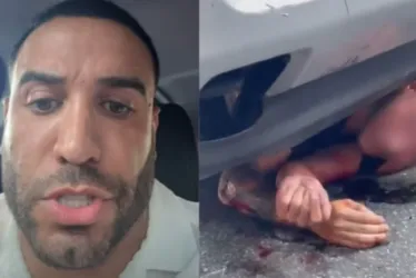 
			
				Homem fica preso sob carro após ser atropelado por pastor
			
			