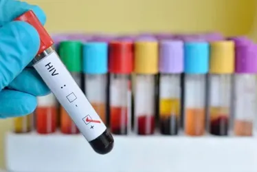 
			
				Mudanças climáticas são associadas à pior prevenção do HIV, diz estudo
			
			