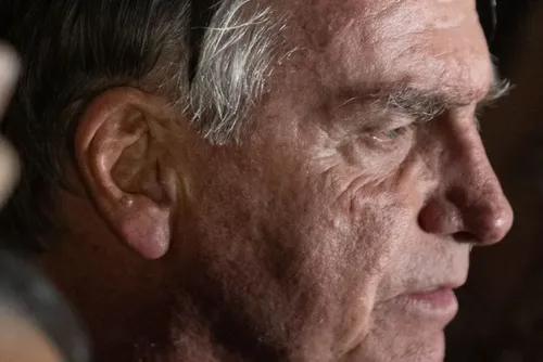 
				Pós-operatório de Bolsonaro será 'prolongado' e não há previsão de alta
			
			