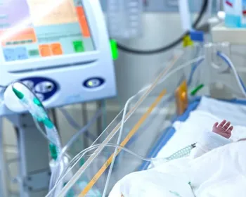 Bebê recém-nascido perde o pênis em cirurgia de circuncisão