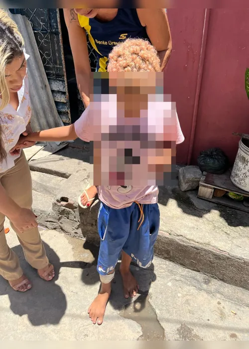 
			
				Conselho Tutelar resgata crianças abandonadas no Trapiche; uma delas foi vista com cigarro na boca
			
			