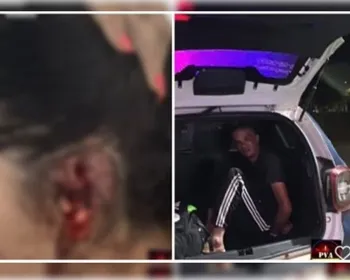 Ciúmes canibal: mulher tem pedaço da orelha arrancado pelo marido