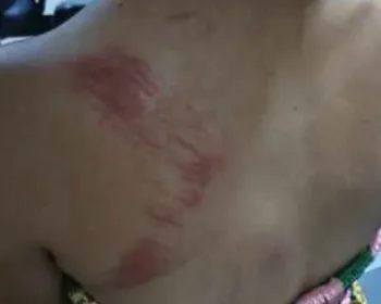 Com ciúmes, homem tenta matar a esposa estrangulada e acaba preso em flagrante