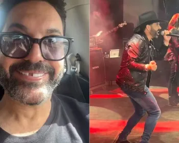 Edson, da dupla com Hudson, revela que perdeu dente ao roer osso a caminho de show