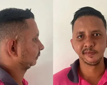 Homem alvo de piada de Carlinhos Maia espera há mais de 10 anos por cirurgia de R$ 471 mil