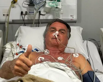 Imagem chocante: Bolsonaro posta foto de alças intestinais nas redes