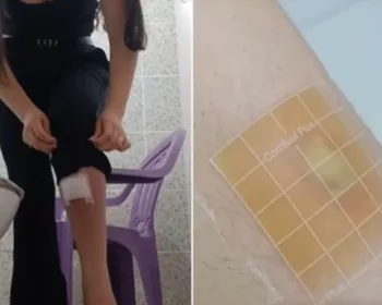 Influenciadora quase fica sem andar após arrancar pelo encravado