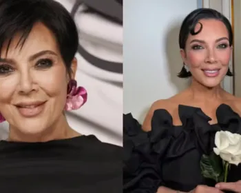 Kris Jenner: qual cirurgia fez a mulher de 69 anos ser comparada às filhas Kardashian?